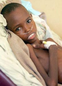 矮妖精貌綜合症 矮妖精貌綜合症