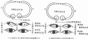 鏇轉變速運動時眼震顫方向示意圖