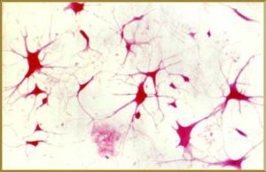 多極神經元 多極神經元