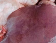 磷化鋅中毒 磷化鋅中毒