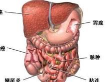 腹腔膿腫