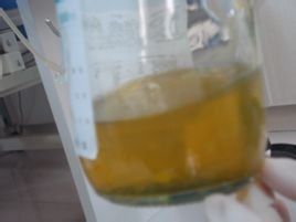 尿蛋白3+ 尿蛋白3+