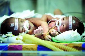 新生兒晚期代謝性酸中毒