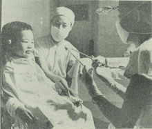 在針刺麻醉下為兒童摘除扁桃體