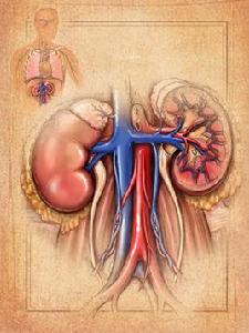 瀰漫性新月體性腎小球腎炎 瀰漫性新月體性腎小球腎炎