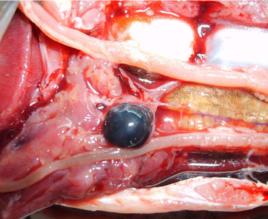 細菌性敗血症 細菌性敗血症