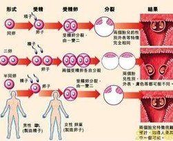 異卵雙胞胎 異卵雙胞胎