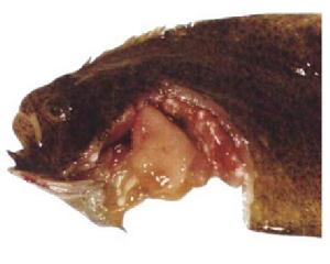 骨髓-胰腺綜合徵