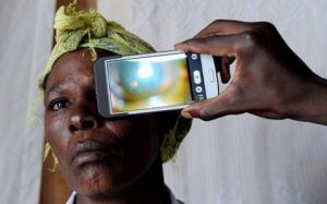 植入式眼壓監測器 植入式眼壓監測器