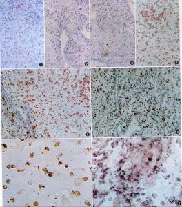 蛻膜組織 蛻膜組織