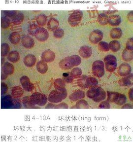 間日瘧 間日瘧