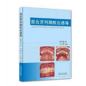 混合牙列期咬合誘導 混合牙列期咬合誘導