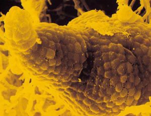 弗蘭克氏菌HR104 弗蘭克氏菌HR104