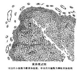 卵巢黃體破裂 卵巢黃體破裂