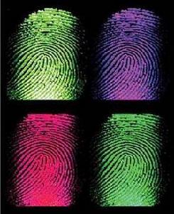 天生指紋缺失 天生指紋缺失