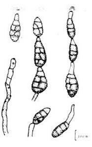 節菱孢黴菌 節菱孢黴菌