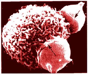 巨噬細胞正在吞噬衰老的紅細胞