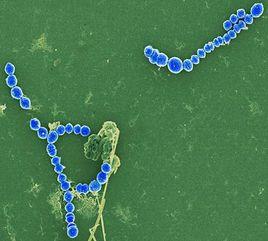 鏈球菌溶血素 鏈球菌溶血素
