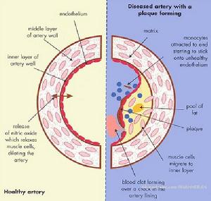 泡沫細胞的形成