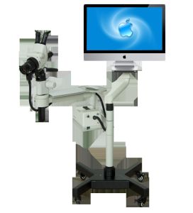 光電一體陰道鏡 光電一體陰道鏡