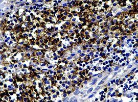 多克隆抗體 多克隆抗體