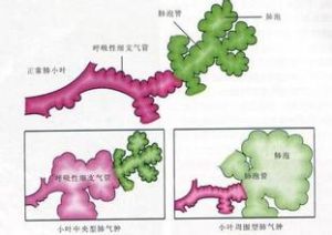 二氧化碳瀦留 二氧化碳瀦留