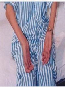 肌肉萎縮 肌肉萎縮