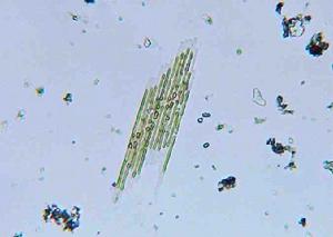 奇異棍形藻 奇異棍形藻