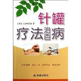 針罐療法治百病 針罐療法治百病