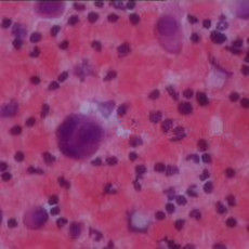 核異質細胞 核異質細胞