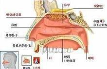 鼻炎症 鼻炎症