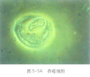 單核吞噬細胞系統