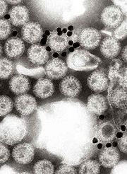（圖）黏在輪狀病毒上的金奈米粒電子顯微鏡影像。圖中的黑色小圓盤是塗上一層單株抗體的金奈米粒，這個單株抗體是專門針對VP6蛋白質製造的。