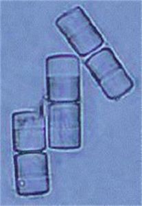 冰島直鏈藻 冰島直鏈藻