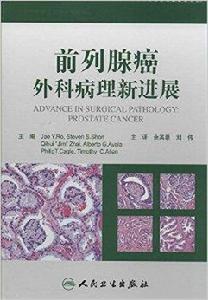 前列腺癌外科病理新進展 前列腺癌外科病理新進展