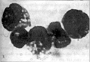 雙炔失碳酯 雙炔失碳酯