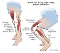 佝僂病和骨質軟化症