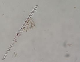 尖針桿藻 尖針桿藻