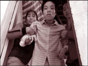 亨廷頓病性痴呆