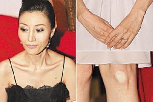 十大女明星雷人指數