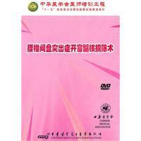 腰椎間盤突出症開窗髓核摘除術 腰椎間盤突出症開窗髓核摘除術