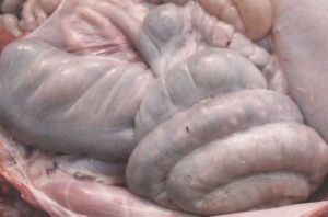 結腸表面有黃色結節