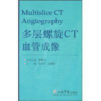 多層螺旋CT血管成像 多層螺旋CT血管成像