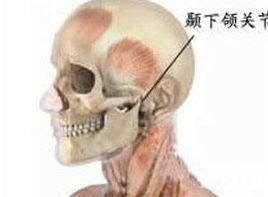 呈開口狀態而不能閉合