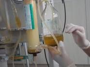 小兒急性腎炎 小兒急性腎炎