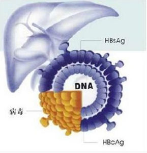 銅代謝障礙 銅代謝障礙