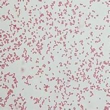 不動桿菌感染 不動桿菌感染