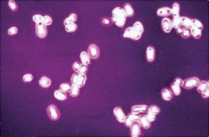 莢膜染色 莢膜染色