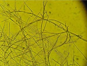 禾穀鐮孢菌 禾穀鐮孢菌