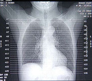 電子鏡子 電子鏡子